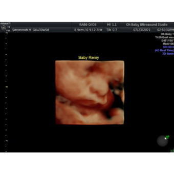 Babylist Registry Photo.