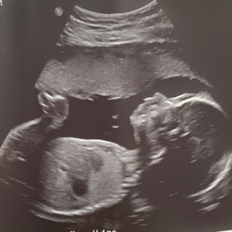 Babylist Registry Photo.