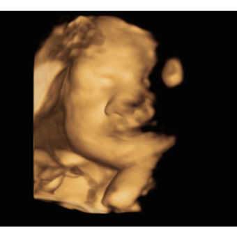 Babylist Registry Photo.