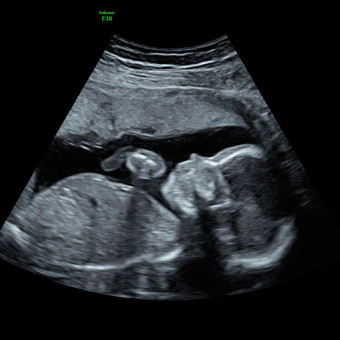 Babylist Registry Photo.