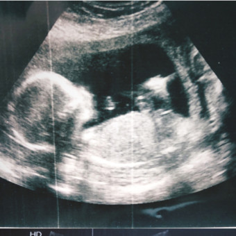 Babylist Registry Photo.