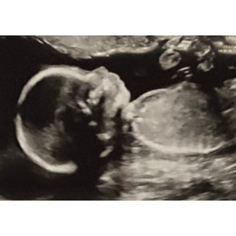 Babylist Registry Photo.