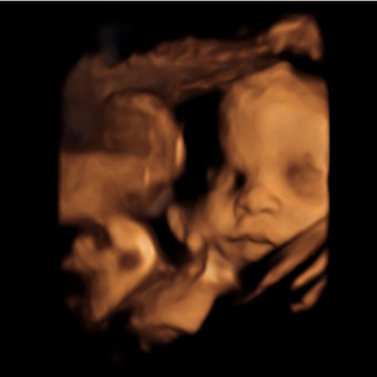 Babylist Registry Photo.