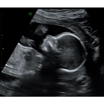 Babylist Registry Photo.