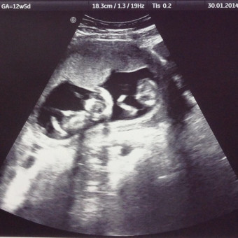 Babylist Registry Photo.