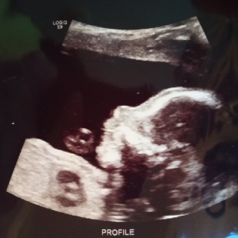 Babylist Registry Photo.