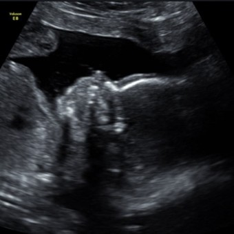 Babylist Registry Photo.