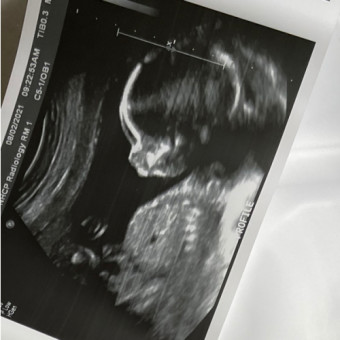 Babylist Registry Photo.