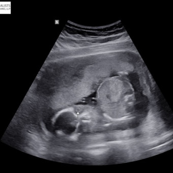 Babylist Registry Photo.