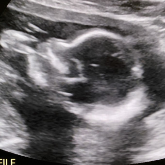 Babylist Registry Photo.