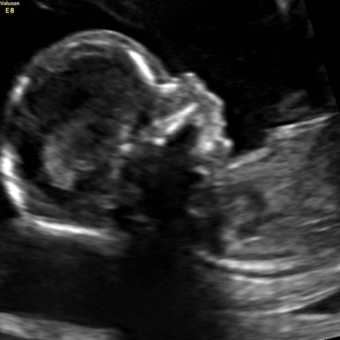 Babylist Registry Photo.