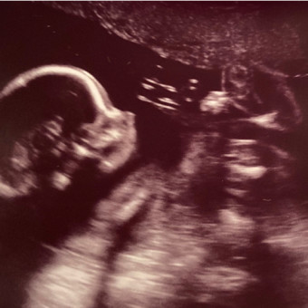 Babylist Registry Photo.