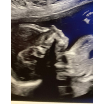 Babylist Registry Photo.