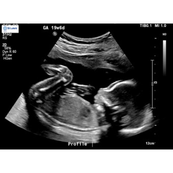 Babylist Registry Photo.
