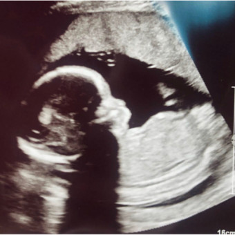 Babylist Registry Photo.