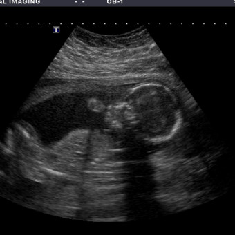 Babylist Registry Photo.