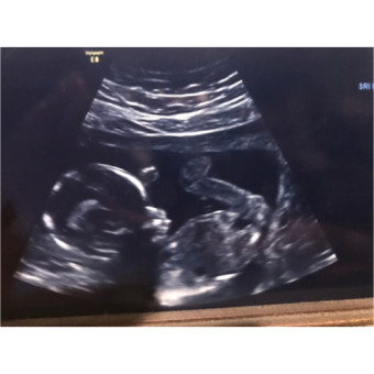 Babylist Registry Photo.