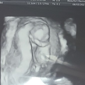 Babylist Registry Photo.