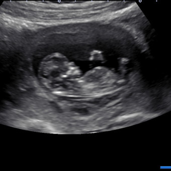 Babylist Registry Photo.
