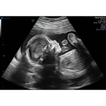 Babylist Registry Photo.