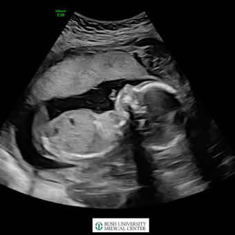 Babylist Registry Photo.