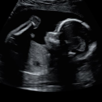 Babylist Registry Photo.