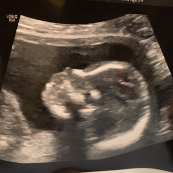 Babylist Registry Photo.