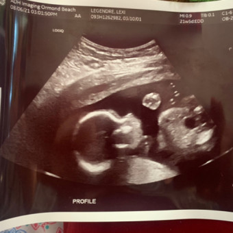 Babylist Registry Photo.