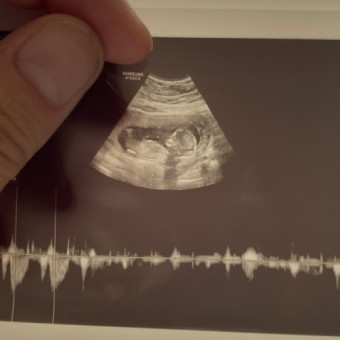Babylist Registry Photo.