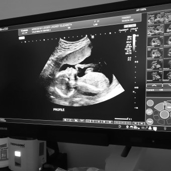 Babylist Registry Photo.