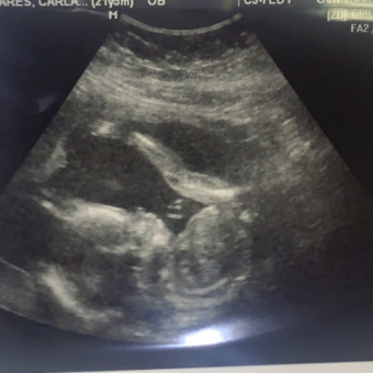 Babylist Registry Photo.