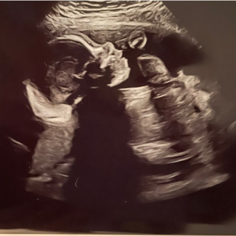 Babylist Registry Photo.