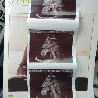 Babylist Registry Photo.