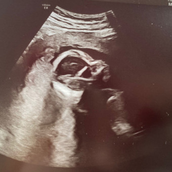 Babylist Registry Photo.