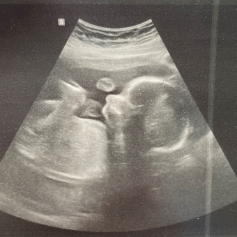 Babylist Registry Photo.