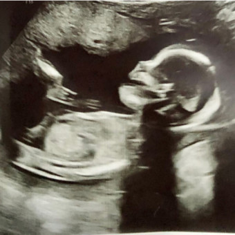 Babylist Registry Photo.