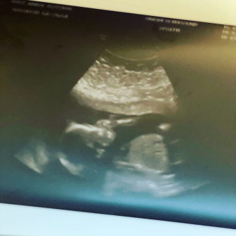 Babylist Registry Photo.
