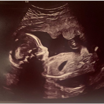 Babylist Registry Photo.