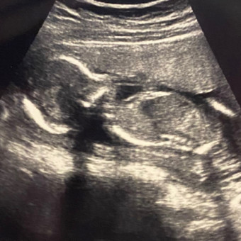 Babylist Registry Photo.