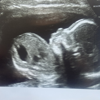 Babylist Registry Photo.