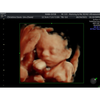 Babylist Registry Photo.