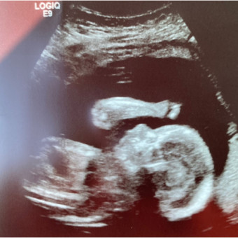 Babylist Registry Photo.