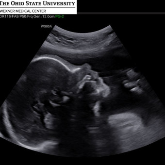 Babylist Registry Photo.
