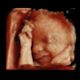 Babylist Registry Photo.