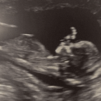 Babylist Registry Photo.