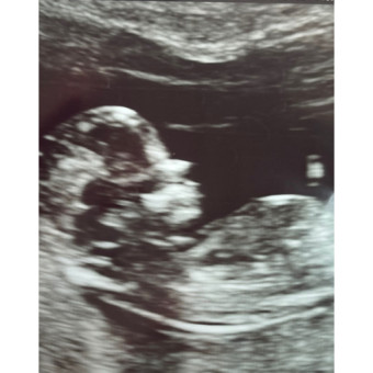 Babylist Registry Photo.