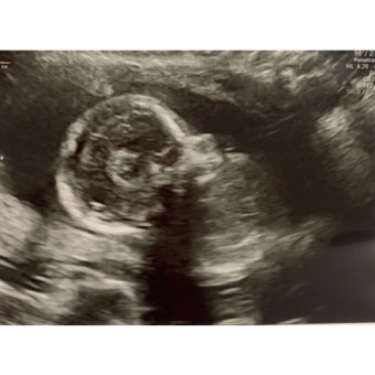 Babylist Registry Photo.