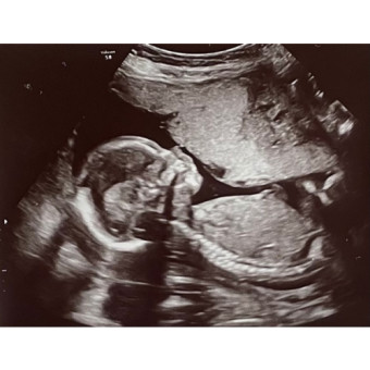 Babylist Registry Photo.