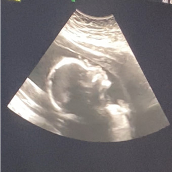 Babylist Registry Photo.