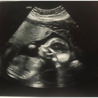 Babylist Registry Photo.